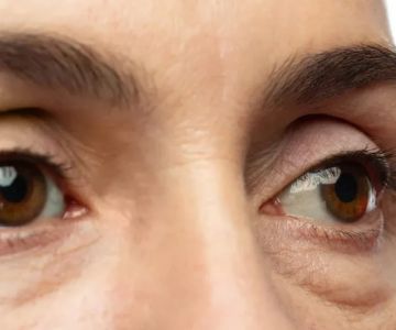 How To Achieve Puffy Eyes With A Simple Routine