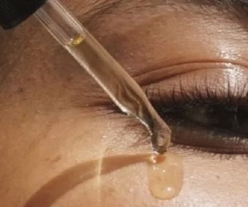 How to Heal Dark Circles Effectively