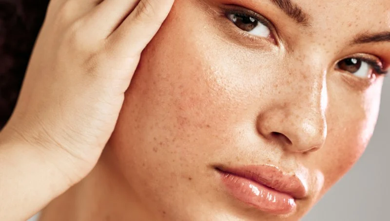 Understanding Retinol To Improve Uneven Skin Tone – A Complete Guide