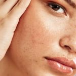 Understanding Retinol To Improve Uneven Skin Tone – A Complete Guide