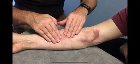 How To Balance Scars and Manage Them Effectively – A Complete Guide