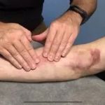 How To Balance Scars and Manage Them Effectively – A Complete Guide