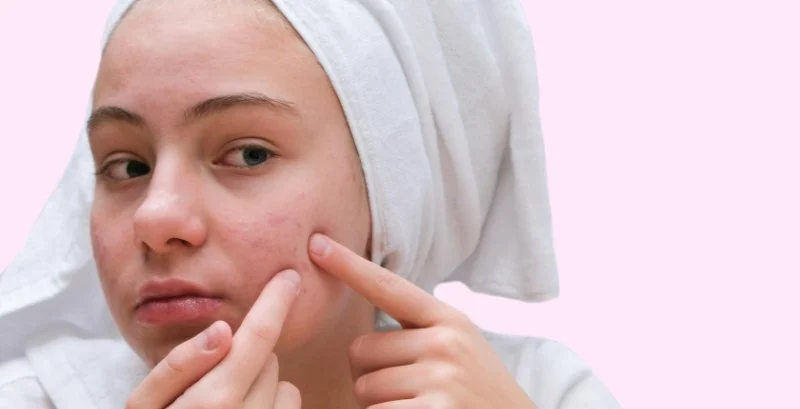 How To Soothe Cleansers to Improve Inflamed Skin Naturally and Effectively