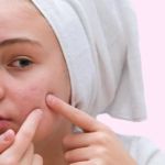 How To Soothe Cleansers to Improve Inflamed Skin Naturally and Effectively