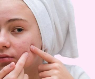 How To Soothe Cleansers to Improve Inflamed Skin Naturally and Effectively