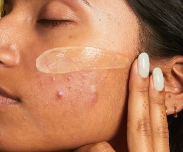 How to Avoid Inflamed Skin and Manage It Effectively