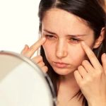 How to Deal with Dark Circles Using Natural Remedies