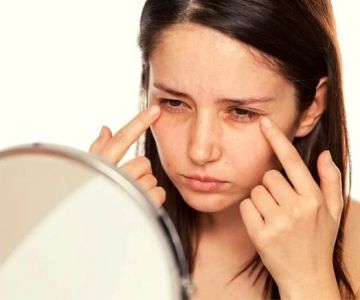 How to Deal with Dark Circles Using Natural Remedies