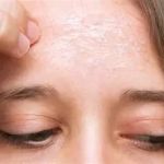 How to Avoid Retinol to Improve Age Spots: Natural Alternatives and Skincare Tips