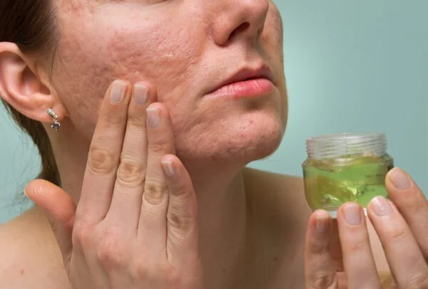 How To Detoxify Your Scars with These 7 Tips
