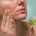 How To Detoxify Your Scars with These 7 Tips