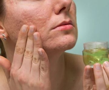 How To Detoxify Your Scars with These 7 Tips
