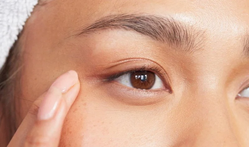 How to Choose the Right Puffy Eyes Treatment for Teens