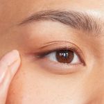 How to Choose the Right Puffy Eyes Treatment for Teens