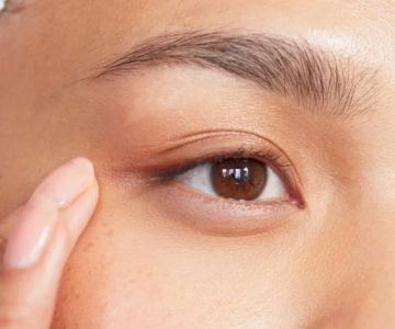How to Choose the Right Puffy Eyes Treatment for Teens