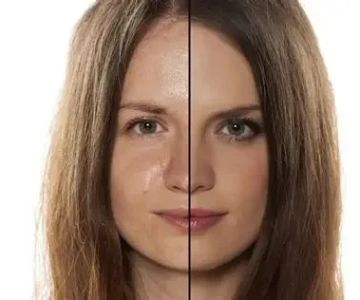 Benefits of Using Dry Skin Care for People with Sensitive Skin