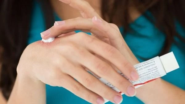 Common Mistakes in Eczema Using Natural Remedies and How to Avoid Them