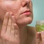 Effective Skin Care Tips to Minimize Scars and Enhance Healing