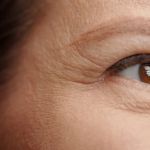 Best Practices for Managing Wrinkles in Sensitive Skin