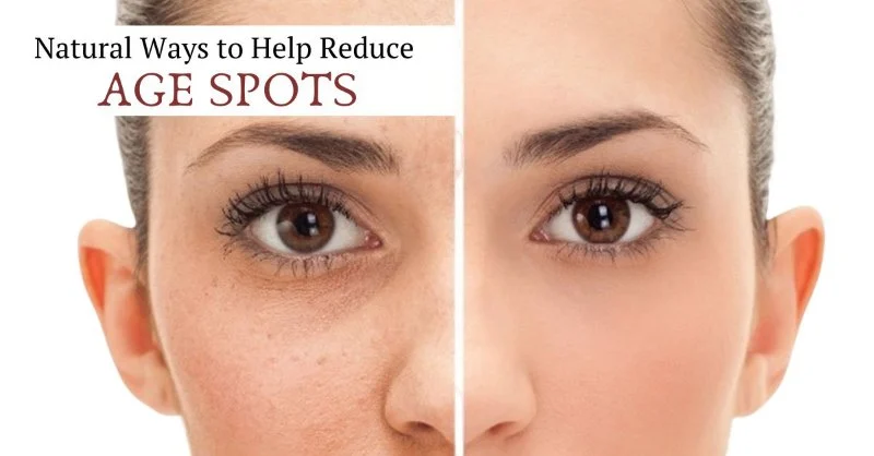 How to Reduce Age Spots with a Simple Routine: Tips for Beautiful, Even Skin