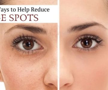 How to Reduce Age Spots with a Simple Routine: Tips for Beautiful, Even Skin