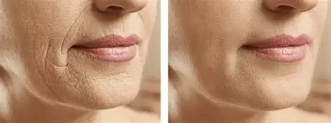 Best Practices for Wrinkles for Women: Effective Anti-Aging Tips