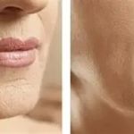 Best Practices for Wrinkles for Women: Effective Anti-Aging Tips