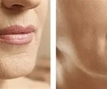 Best Practices for Wrinkles for Women: Effective Anti-Aging Tips