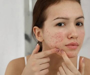 How to Manage Inflamed Skin for People with Combination Skin – Expert Tips