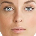 Skin Care Tips for Uneven Skin Tone With A Simple Routine