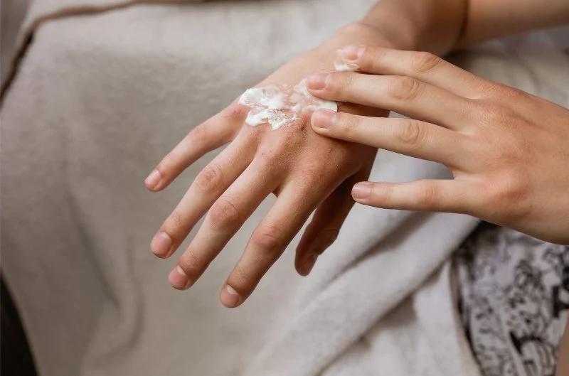 How to Treat Eczema with a Simple Routine