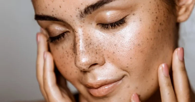 How To Get Rid Of Dull Skin and How To Manage It for Glowing Skin