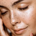 How To Get Rid Of Dull Skin and How To Manage It for Glowing Skin