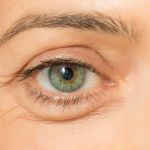 How To Get Rid Of Puffy Eyes: What You Need To Know