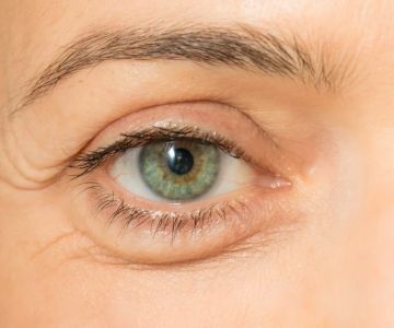 How To Get Rid Of Puffy Eyes: What You Need To Know