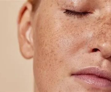 How To Deal With Sensitive Skin With A Simple Routine: Tips for Healthy Skin