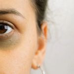 How To Prevent Your Dark Circles With These 7 Tips