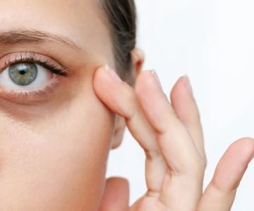 How to Deal with Dark Circles Using Natural Remedies: Effective Solutions
