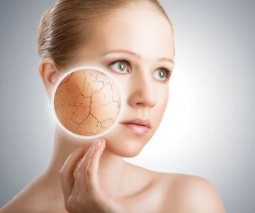 How To Balance Your Dry Skin With These 10 Tips – Expert Care and Real-Life Solutions