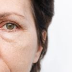 Daily Skin Care Routine For Puffy Eyes: What You Need To Know