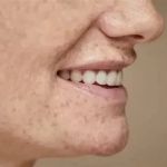 How To Avoid Retinol to Improve Age Spots Safely and Effectively