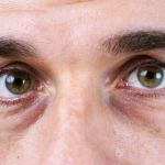 Daily Skin Care Routine for Puffy Eyes | Tips for Healthy, Bright Eyes