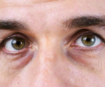 Daily Skin Care Routine for Puffy Eyes | Tips for Healthy, Bright Eyes