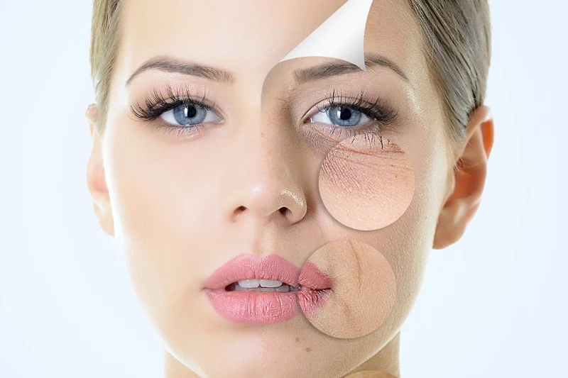 Top Tips for Reducing Fine Lines in Women