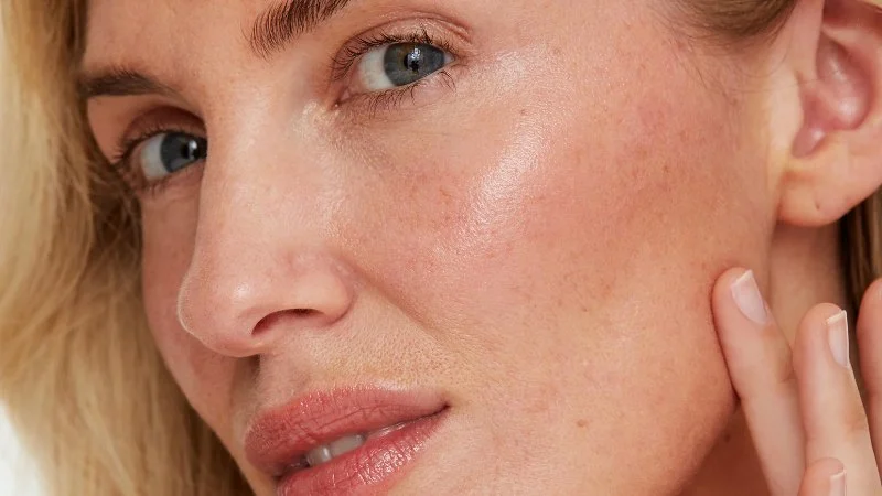 How To Soothe Redness For People Living In Humid Climates