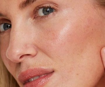 How To Soothe Redness For People Living In Humid Climates