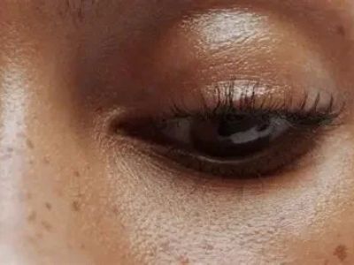 How To Avoid Uneven Skin Tone Effectively | SkinCare Experts