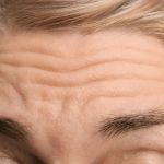 How To Avoid Wrinkles In People Living In Humid Climates