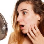 The Science Behind Acne And How To Manage It