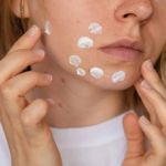 How To Choose The Right Hyperpigmentation Treatment: What You Need To Know